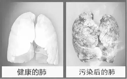 雾霾为何引起咳嗽 对肺有多大危害?