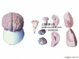 大脑剖面模型