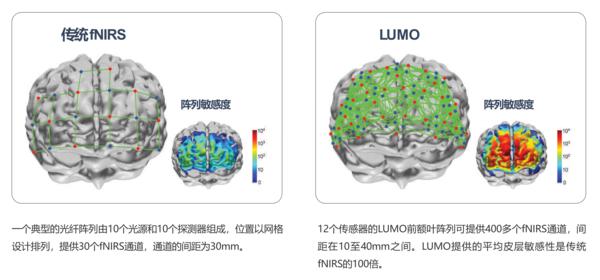 英国UCL可穿戴高密度脑成像系统