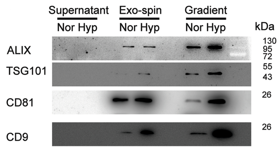 Scientific Reports：使用单外泌体表征分析技术与蛋白组学检测乏氧状态的肾细胞癌外泌体