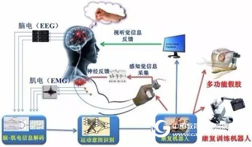 delsys肌电实现“意念指挥” 听话假肢灵活应用