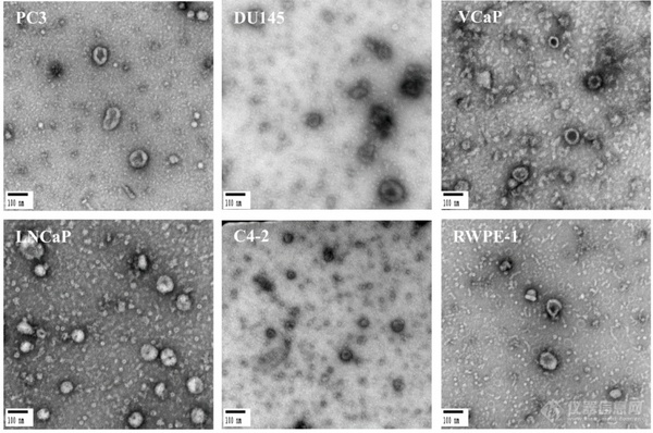 外泌体粒径分析该选谁？不同外泌体粒径分析技术间的比较