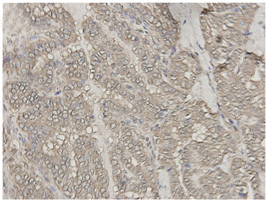 Anti BRaf(V600E) Mouse Monoclonal Antibody